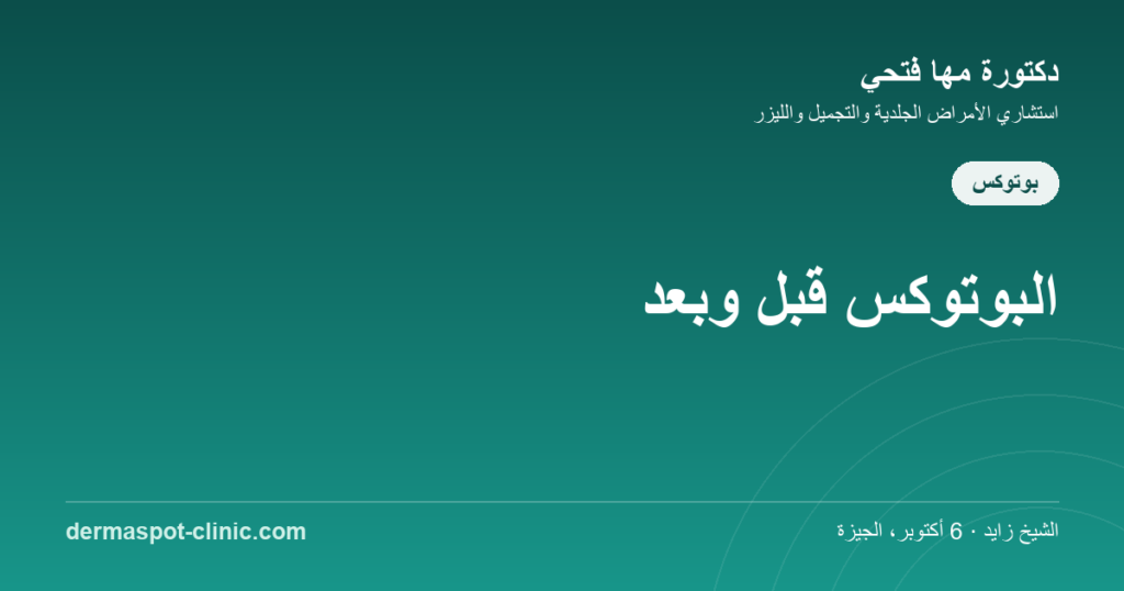 البوتوكس قبل وبعد - نتائج واقعية، دكتورة مها فتحي ديرماسبوت