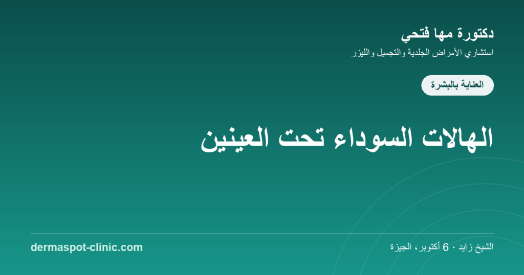 الهالات السوداء تحت العينين الأسباب والعلاج، دكتورة مها فتحي ديرماسبوت