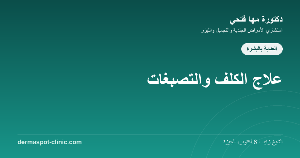 علاج الكلف والتصبغات في مصر، دكتورة مها فتحي ديرماسبوت
