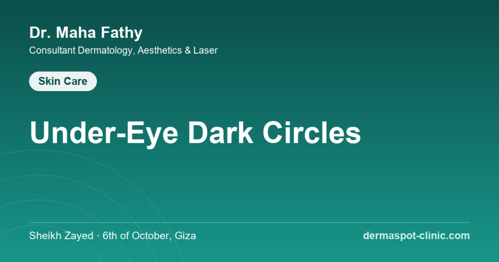Under eye dark circles causes and treatment, Dr. Maha Fathy DermaSpot